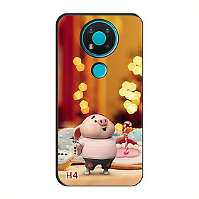 Ốp Dẻo Dành Cho NOKIA 3.4