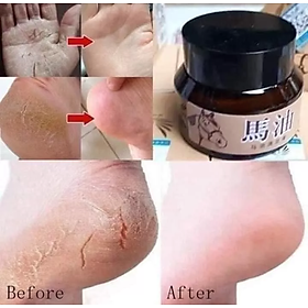 HỘP KEM BÔI HẾT NỨT NẺ TOÀN THÂN CHÂN TAY CAM KẾT HÀNG CHUẨN