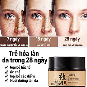 Mua Kem loại bỏ nám đen tàn nhang dưỡng ẩm cải thiện hiệu quả cao từ thảo dược hàng chất lượng  cách xóa tàn nhang nám đen tại nhà an toàn