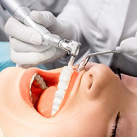 Cạo vôi đánh bóng hoặc trám răng chất lượng cao - Nha khoa Đăng Khang