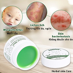 Mua Kem dưỡng da  bôi vết ngứa do côn trùng  vi khuẩn  kí sinh trùng gây ra  tinh chất thảo dược thiên nhiên  tặng kèm vòng tay Luminous