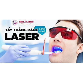 Gói Dịch Vụ 2 Lần Tẩy Trắng Răng Tại Nha Khoa Thẩm Mỹ Hồng Ân