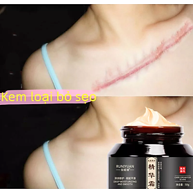 Mua KEM XÓA ĐÁNH BAY LÀM MỜ MỌI VẾT SẸO TRÊN DA HOÀN TOÀN CAM KẾT HÀNG CHUẨN