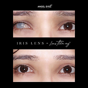 Lens thẩm mỹ che khuyết điểm Angel Eyes dành cho mắt bị đục thủy tinh thế, kéo mây, cườm