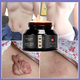 Kem bôi xóa mờ sẹo lồi lõm lâu năm , rạn da sau sinh, vết thâm do mụn cải thiện hiệu quả giúp da láng mịn