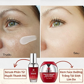 Hình ảnh [MISS CANDY] Combo 2 Sản Phẩm Trắng Da Mờ Thâm, Sạm, Nám, Tàn Nhang Giúp Tái Sinh Làn Da Gồm Serum HA Peptide 30ml + Kem Dưỡng Trắng Da Face Nano 30g MISS CANDY - Gia Tuệ House