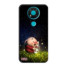 Ốp Dẻo Dành Cho NOKIA 3.4