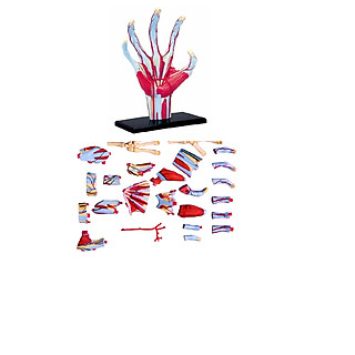 Mô hình phẫu thuật  Tay