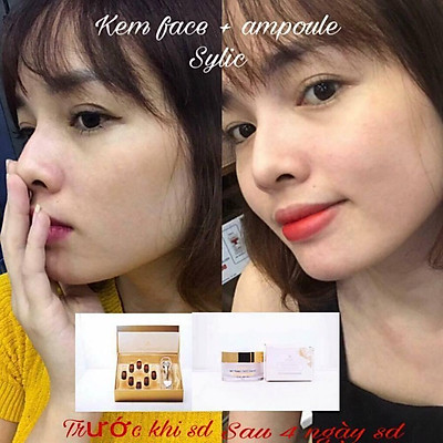 Bộ tinh chất tế bào gốc Ampoule Sylic tặng kèm lăn kim 0.2mm