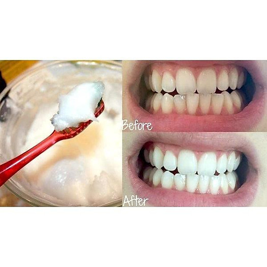 Combo 5 Hộp Baking Soda Chuyên Tẩy Rửa ,Dễ Sử Dụng