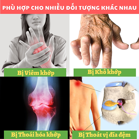 Toxmin flex - viên uống bổ xương khớp, giúp dưỡng khớp, chống viêm - ảnh sản phẩm 3