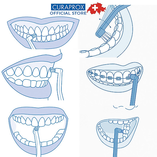 Bộ chăm sóc răng niềng curaprox ortho kit màu sắc bàn chải bất kỳ - ảnh sản phẩm 6