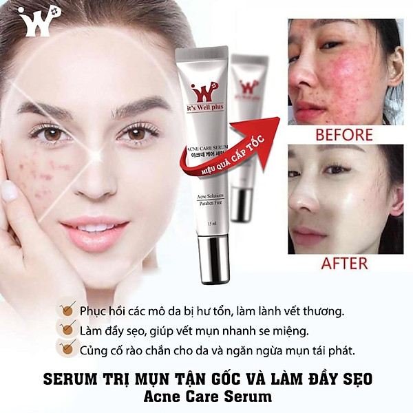 Serum Hỗ Trợ Làm Giảm Mụn It'S Well Plus Acne Care Serum 15ml