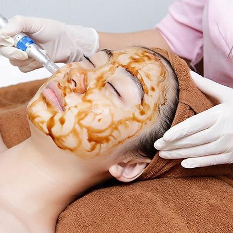 Liệu Trình Cấy Tảo Hồng Sâm