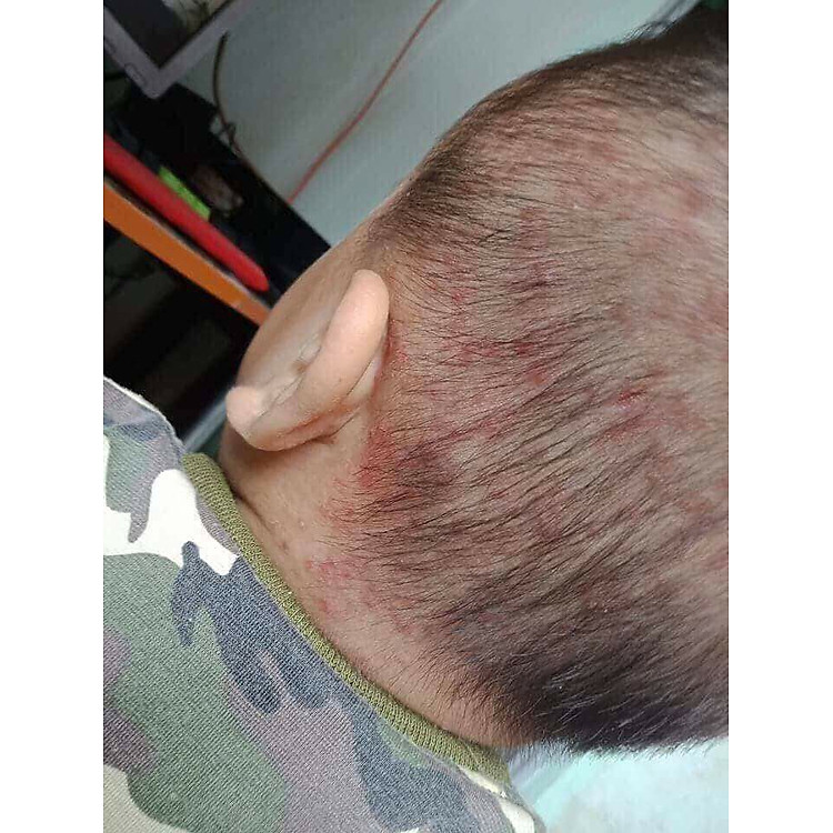 Sữa tắm lá khổ qua Mẹ Ken 100ML Chính hãng Giá rẻ - Hình ảnh 3