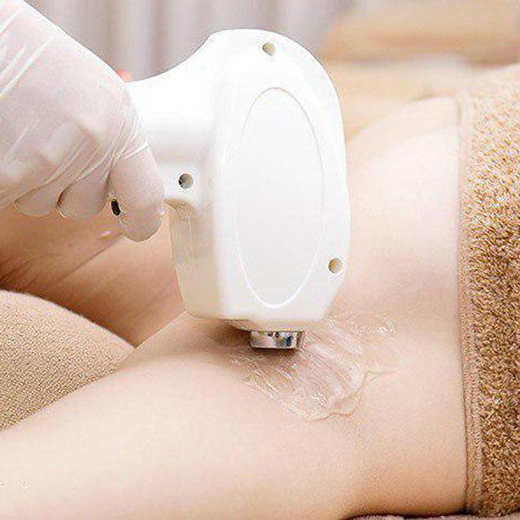 Triệt Lông Vĩnh Viễn