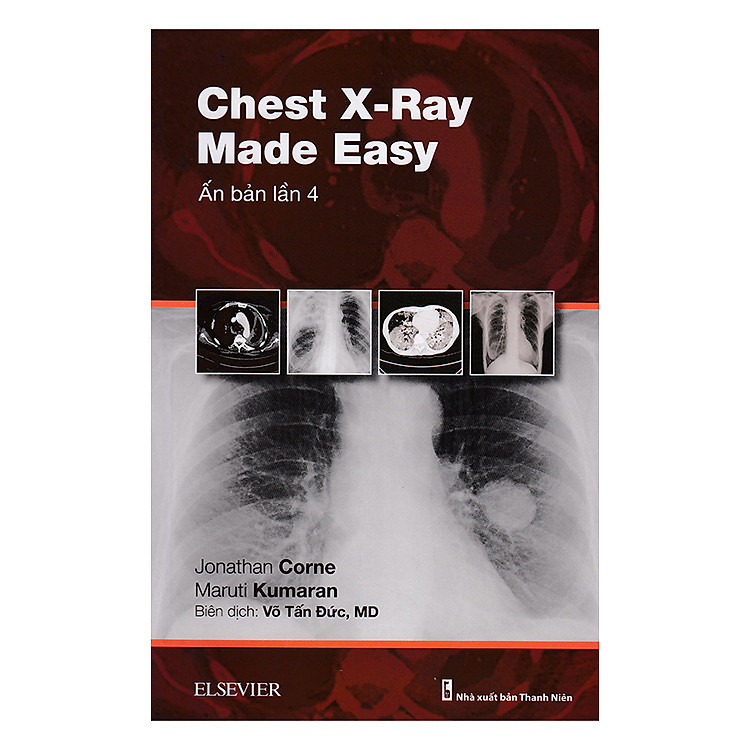 Sách Chest X-Ray Made Easy (Ấn Bản Lần 4)