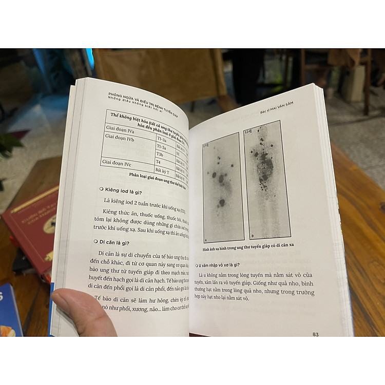PHÒNG NGỪA VÀ ĐIỀU TRỊ BỆNH TUYẾN GIÁP – Những điều không biết hỏi ai - Ảnh 5