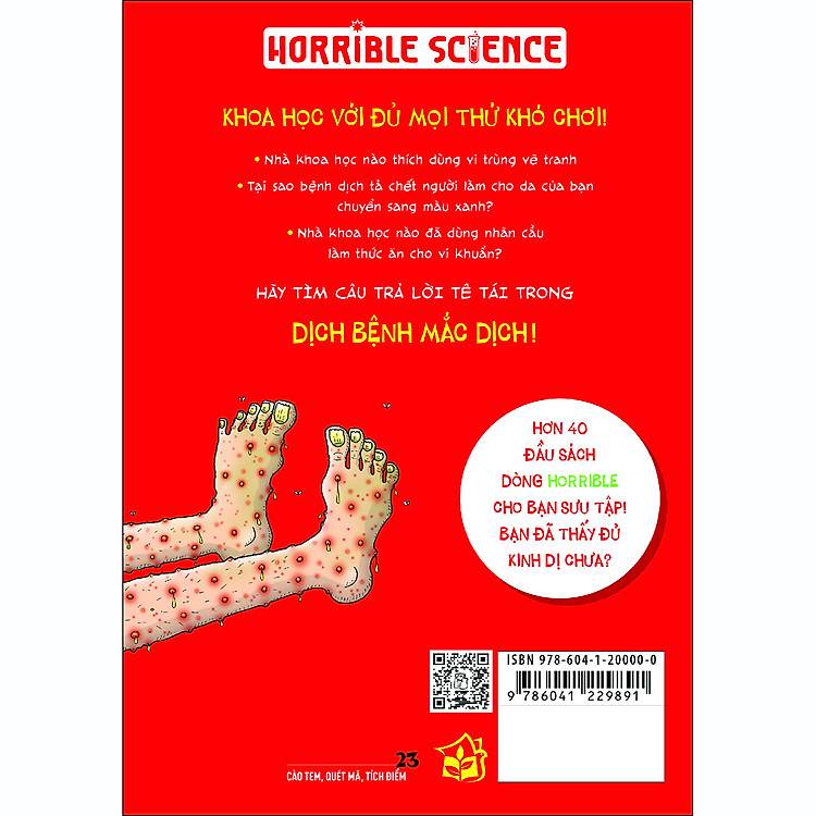 Kiến thức hấp dẫn. Dịch bệnh mắc dịch (Horrible Science) - Ảnh 2