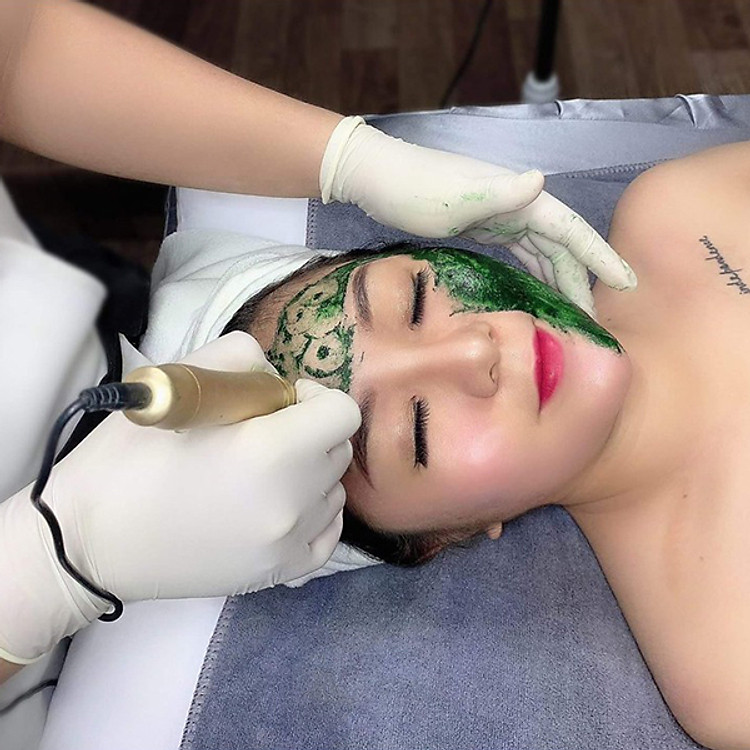 Liệu Trình Cấy Tảo Xoắn Tại SOJO Beauty