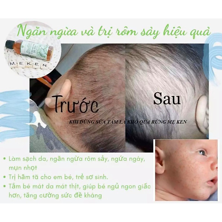 Sữa Tắm Lá Khổ Qua Rừng Mẹ Ken 100ML Chính hãng Ưu đãi - Hình ảnh 3