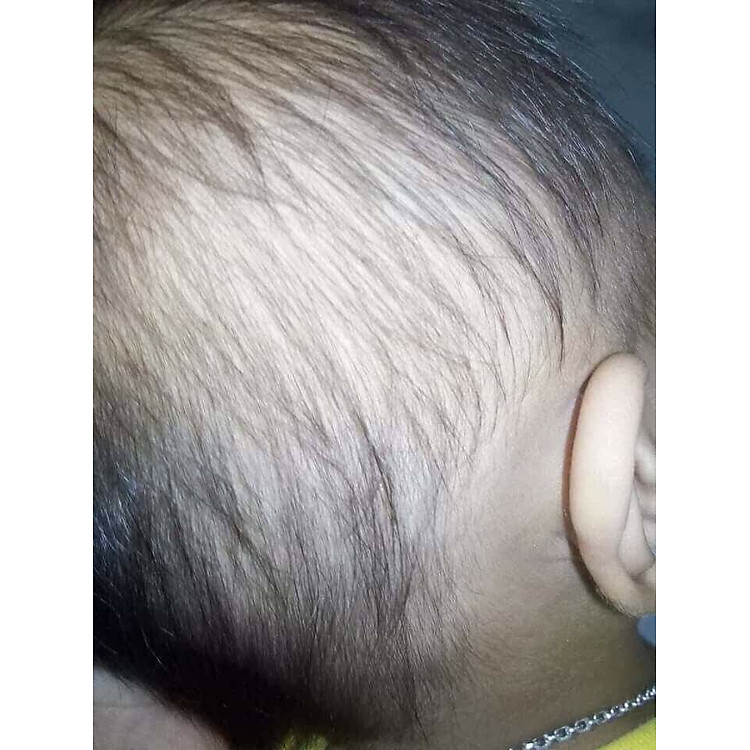 Mua Sữa Tắm Lá Khổ Qua Rừng 500ML Chính hãng Giá rẻ - Hình ảnh 5