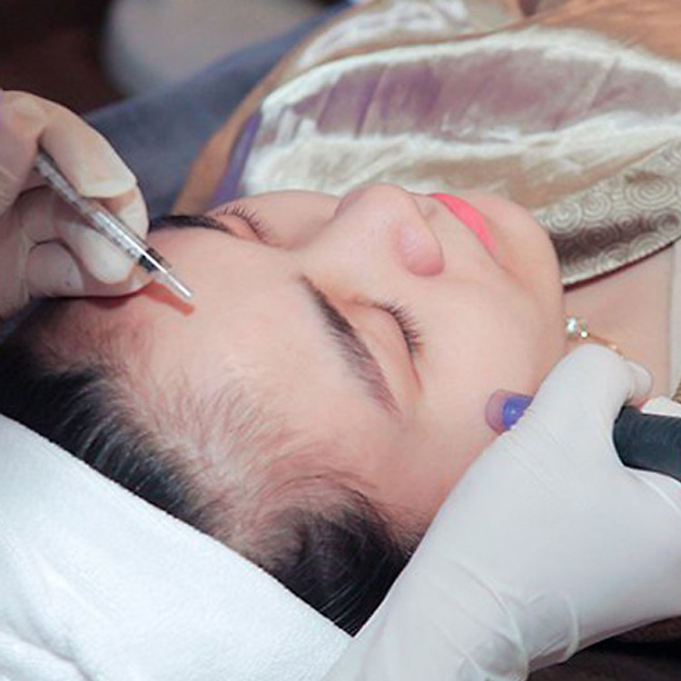 Tẩy 03 nốt ruồi, mụn cóc, thịt thừa bằng công nghệ Pico Lazer tại Akira Spa