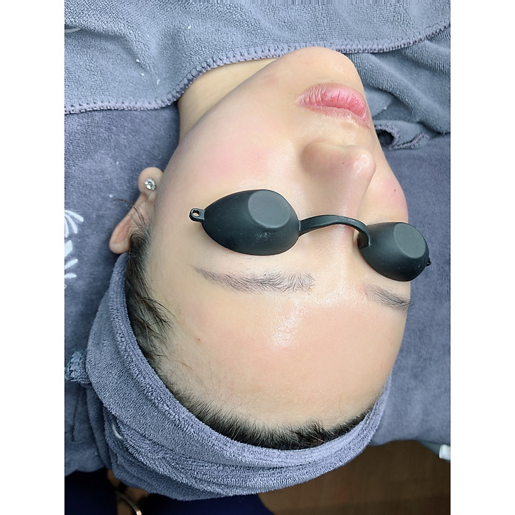 Gói nặn mụn cơ bản_Q Beauty Spa