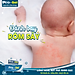 Gel Bôi Bỏng, Hăm Da, Tay Chân Miệng, Mụn Nhọt, Côn Trùng Đốt, Rôm Sảy, Zona, Thủy Đậu Pro - Gel Nano Bạc