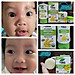 ING Organic After Balm - Kem Hữu Cơ Thoa Vết Muỗi Và Côn Trùng Đốt - Không Ngứa - Không Sưng Đỏ - Không Sẹo Thâm
