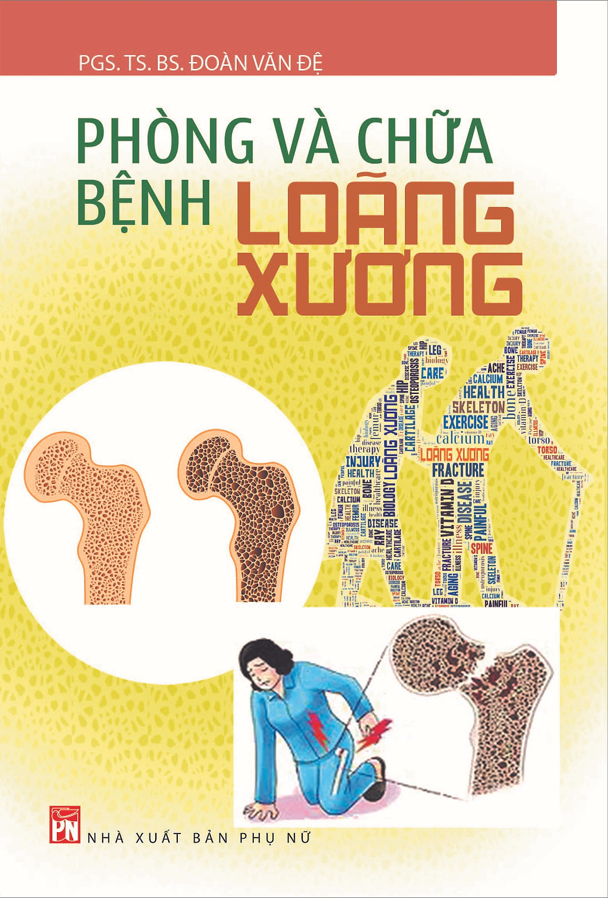 Phòng Và Chữa Bệnh Loãng Xương