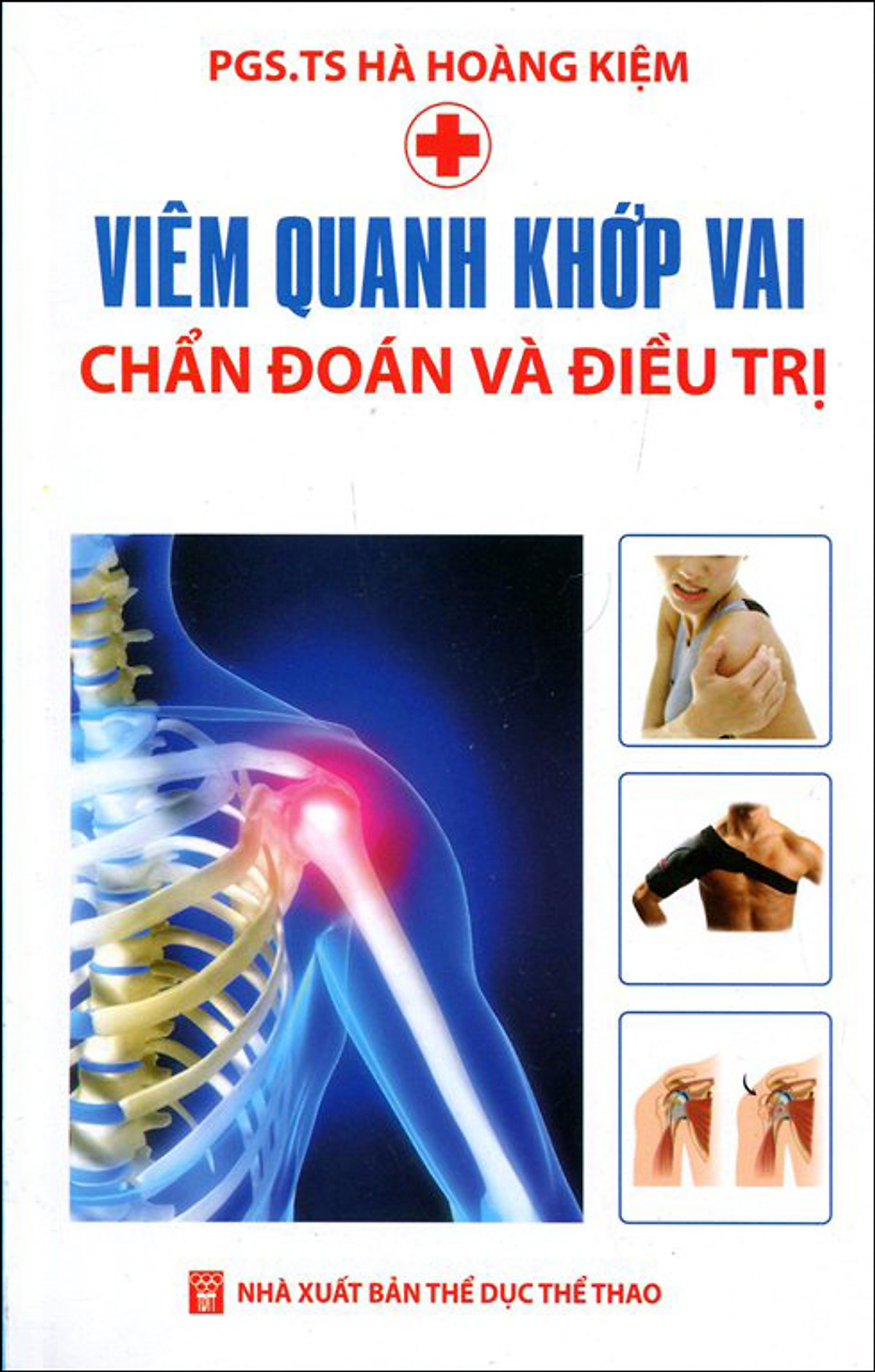 Viêm Quanh Khớp Vai - Chẩn Đoán Và Điều Trị