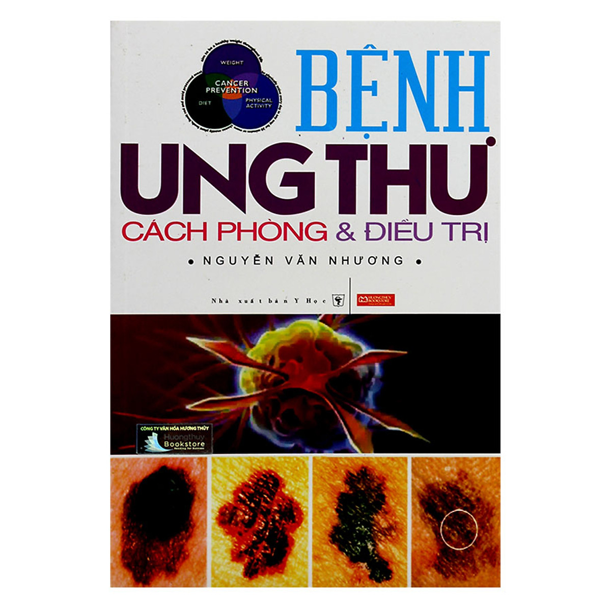 Bệnh Ung Thư Cách Phòng Và Điều Trị