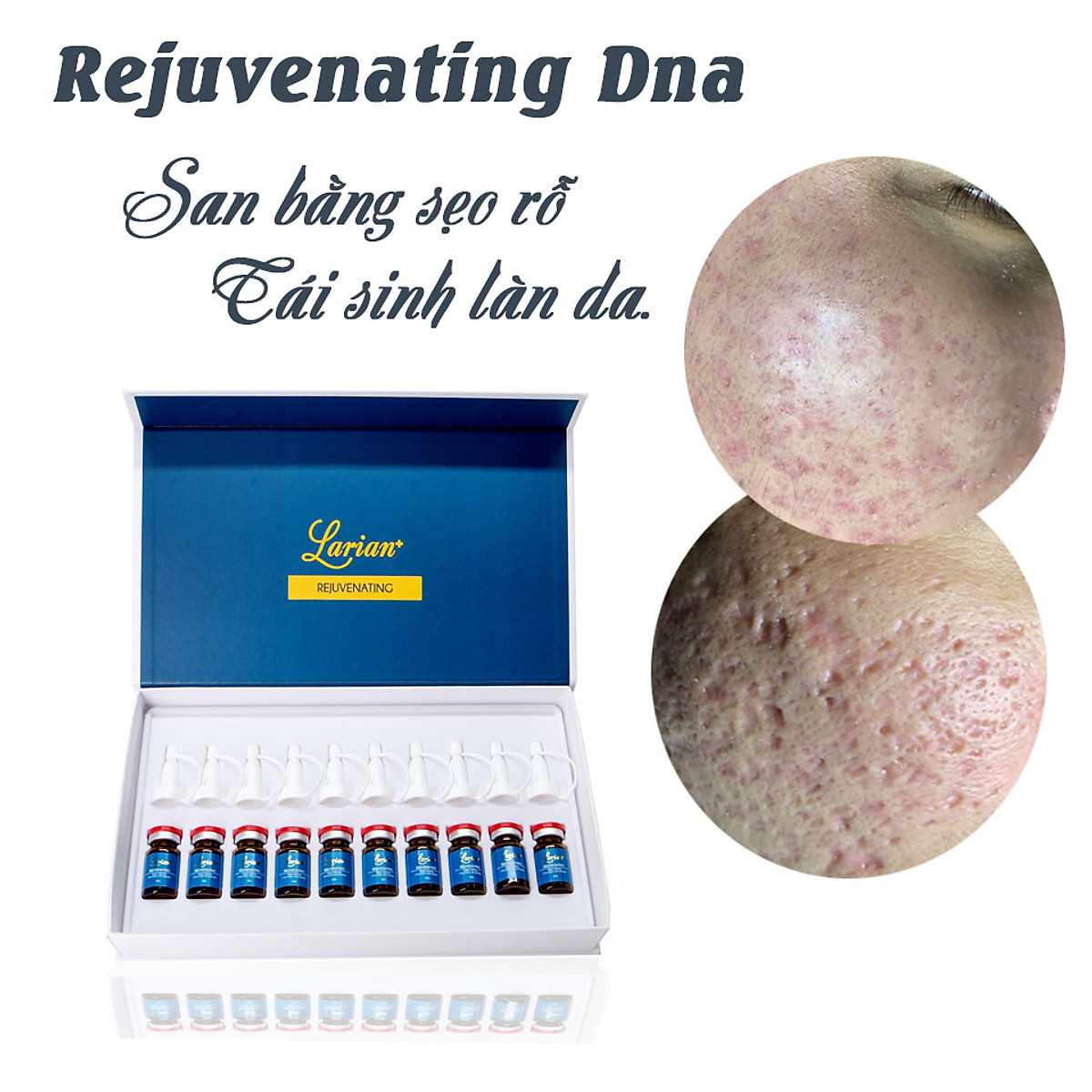 Hộp 10 lọ Tế bào gốc DNA cá hồi hỗ trợ cải thiện sẹo rỗ LARIAN REJUVENATING  | Larianplus | Tiki