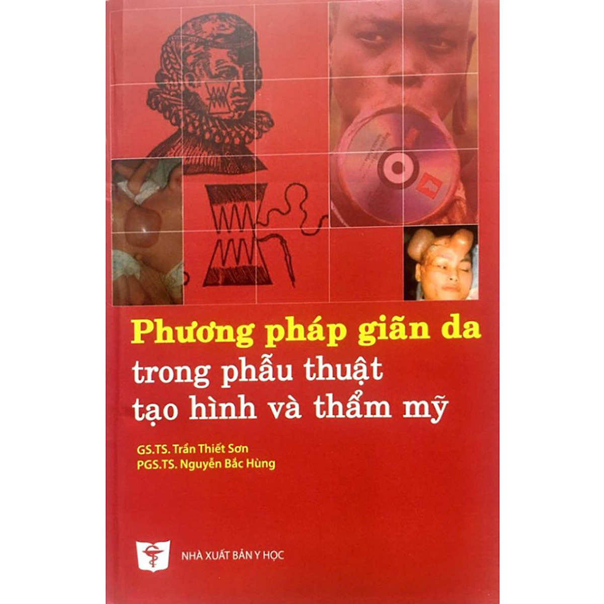 Phương pháp giãn da trong phẫu thuật tạo hình và thẩm mỹ