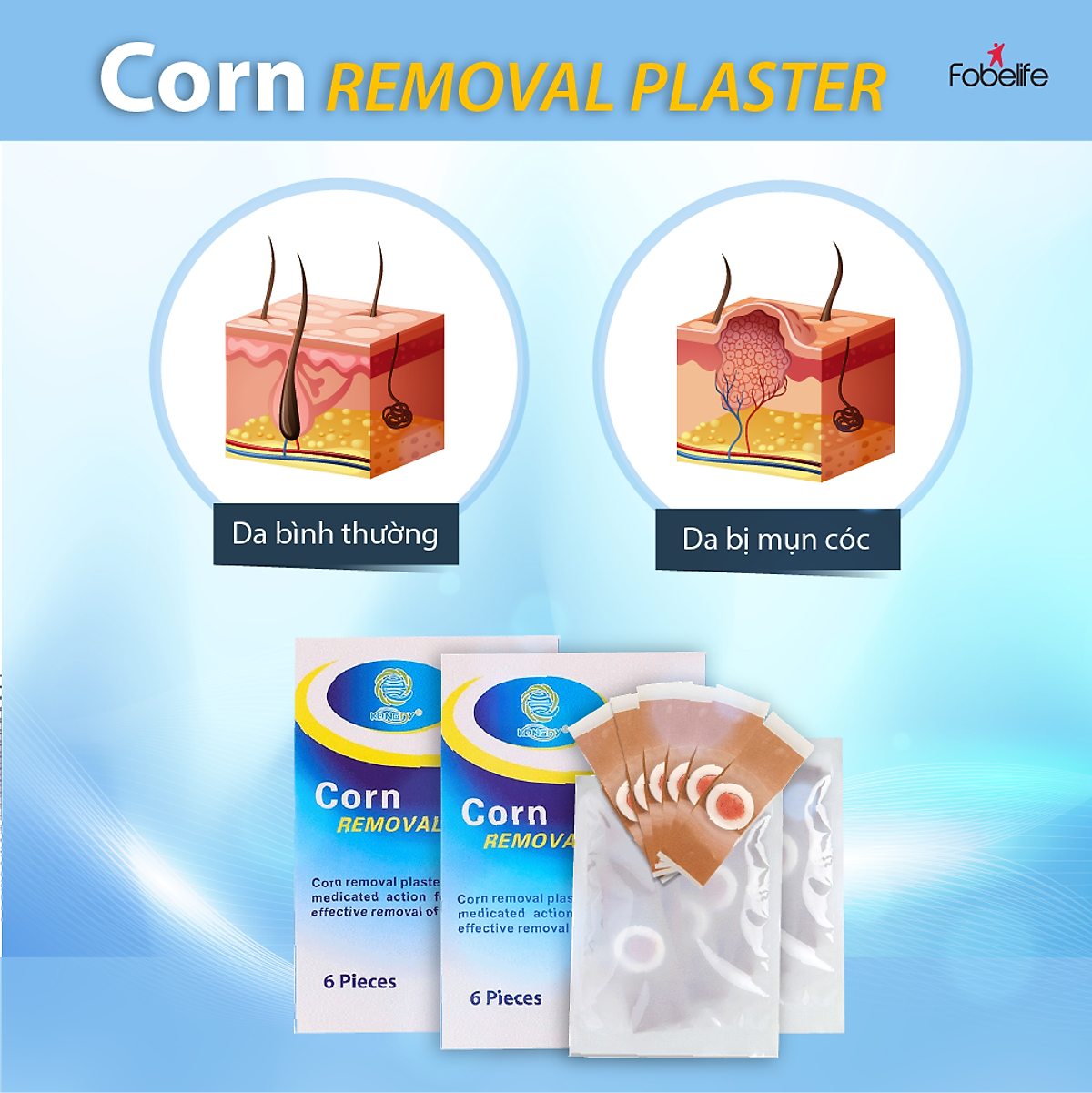 Combo 2 Hộp Miếng Dán Mụn Cóc Loại Bỏ Mụn Cóc Tại Nhà An Toàn Hiệu Quả - Hộp 6 miếng