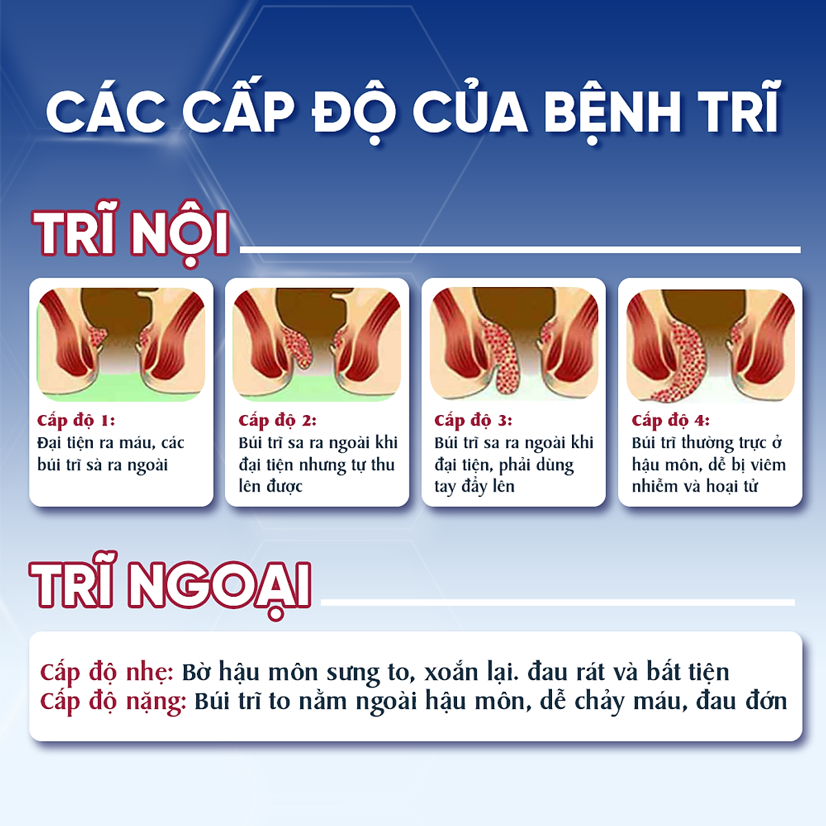 Viên Uống Hỗ Trợ Co Thắt Búi Trĩ Trimax Hủ 30 Viên Nguyên Liệu Từ Thiên Nhiên