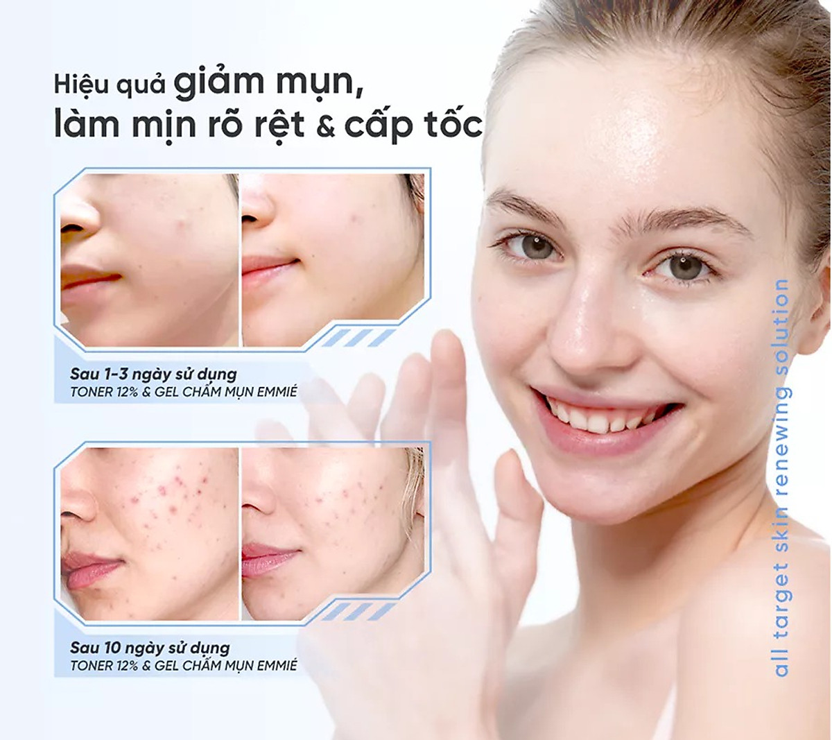 Dung dịch tẩy tế bào chết và tái tạo da Emmié All Target Skin Renewing Solution Pionin + 12% AHA/BHA/PHA (120ml) - Hàng chính hãng
