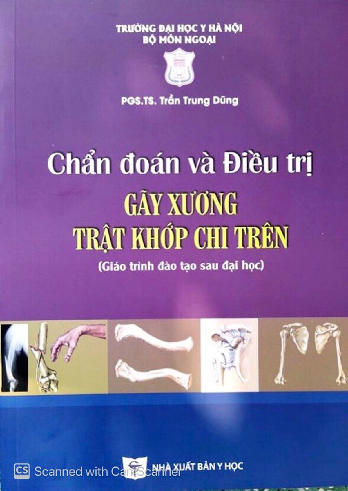 Chẩn đoán và điều trị Gãy xương trật khớp Chi trên - Chi dưới