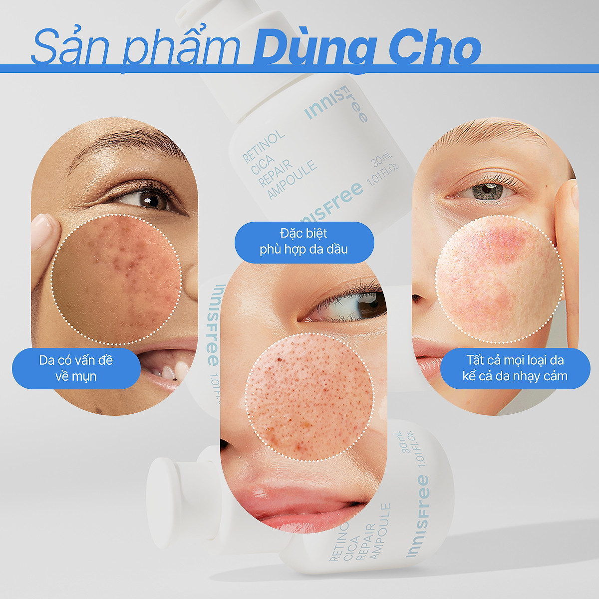 Serum Kiểm Soát Dầu Mụn Cho Da Láng Mịn INNISFREE Retinol Cica Repair Ampoule 30mL
