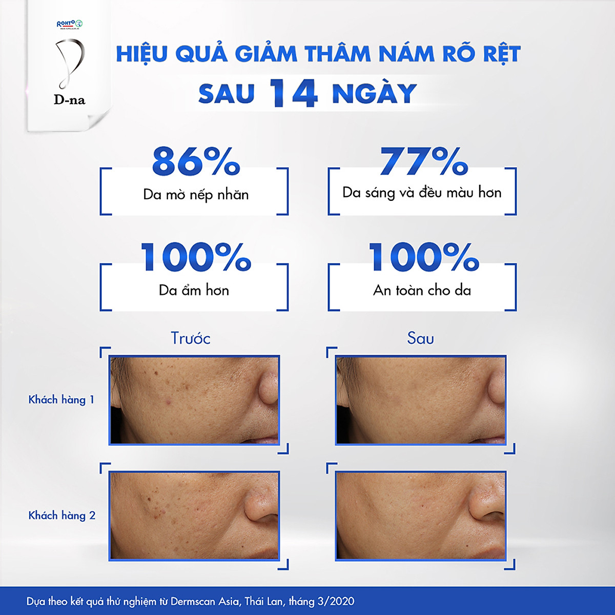 Viên uống sáng da glutathione D-na Whitening Supplement (60 Viên)