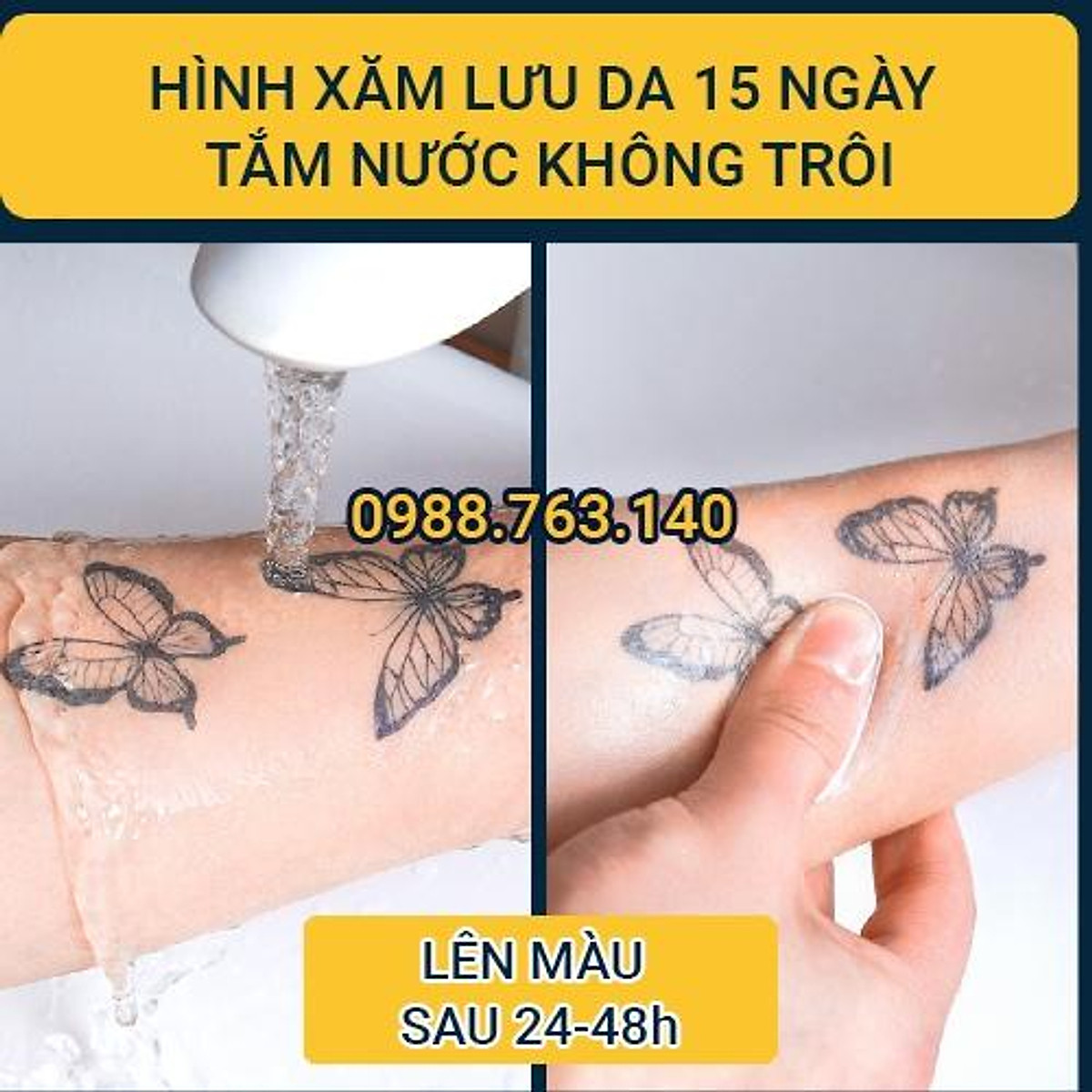 Hàn Quốc phát triển hình xăm công nghệ nano giúp cảnh báo các vấn đề sức  khỏe  Nhịp sống kinh tế Việt Nam  Thế giới