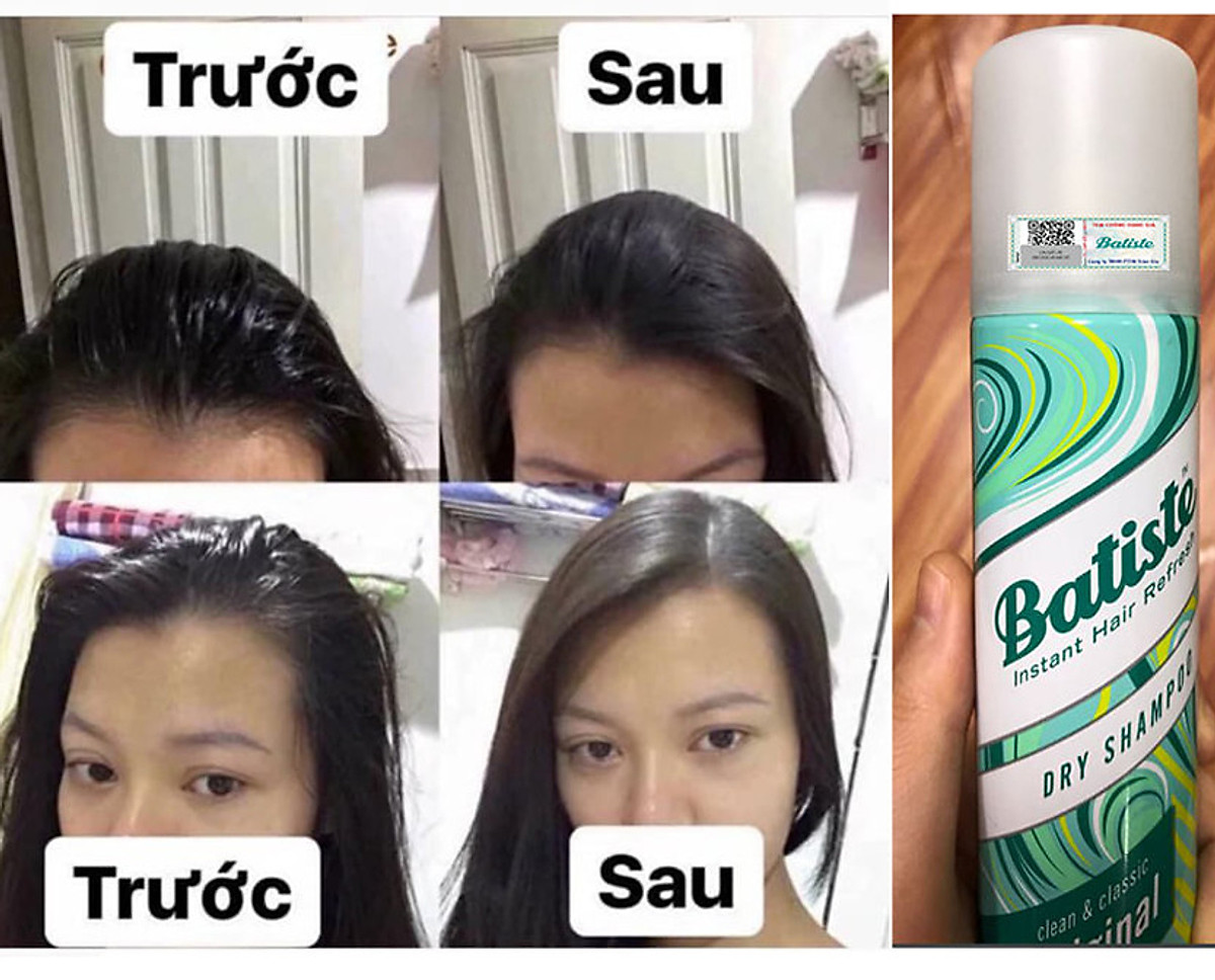 Dầu Gội Khô Batiste Dry Shampoo 200ml Hết Ngứa, Hết Bết Dính Tóc Bồng Bềnh  Tức Thì | Mỹ Phẩm Coco&#39;s Beauty | Tiki