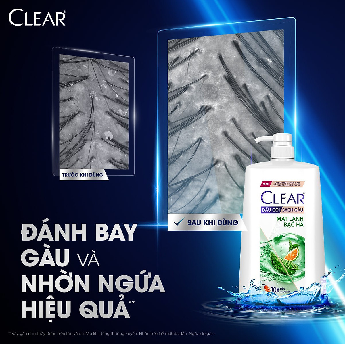 Dầu Gội Clear Sạch Gàu Dầu Gội Sạch Gàu Mát Lạnh Bạc Hà 3X Sức Mạnh Đánh Bay Gàu, Ngứa, Vi Khuẩn 1.4kg