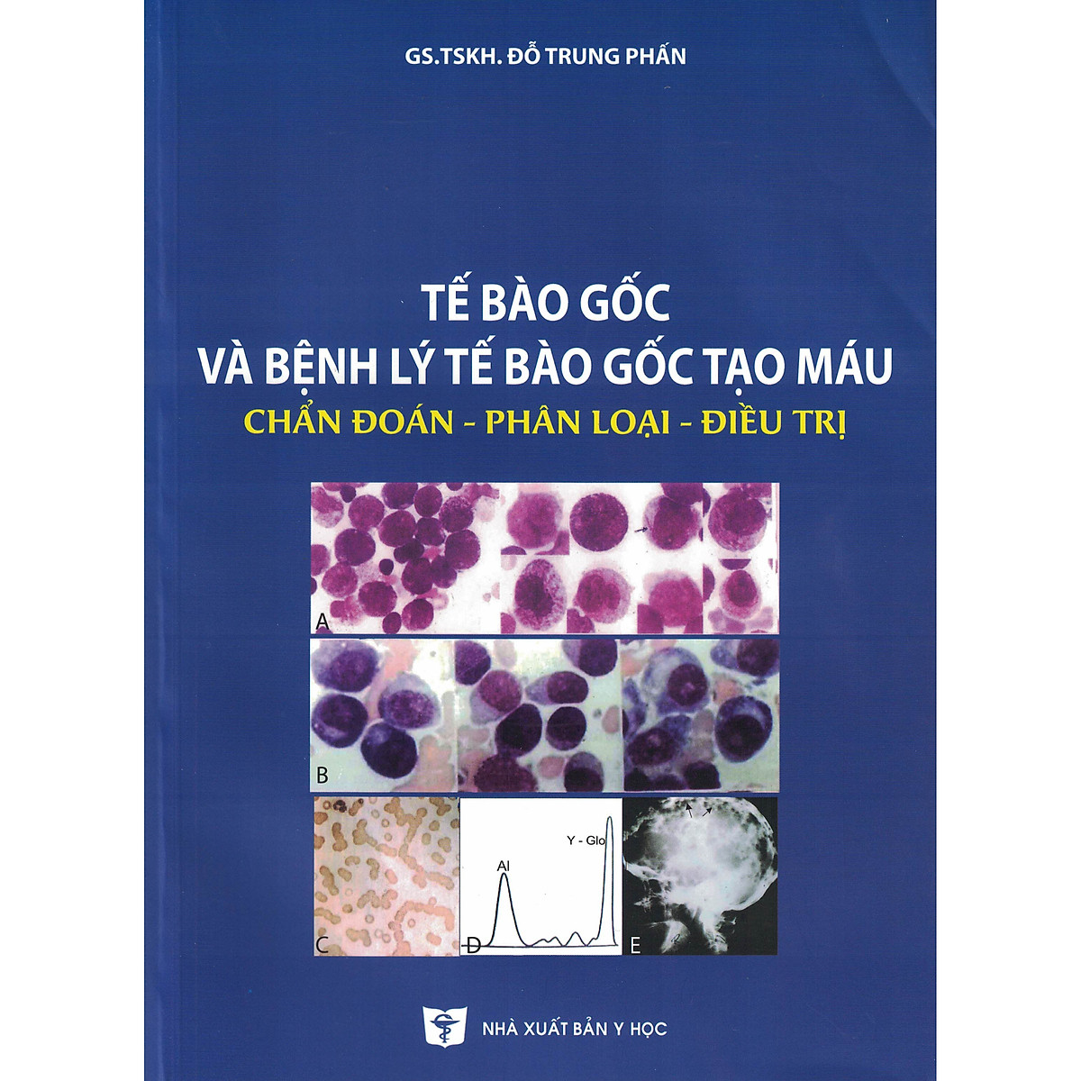 Tế Bào Gốc Và Bệnh Lý Tế Bào Gốc Tạo Máu Chẩn Đoán - Phân Loại - Điều Trị