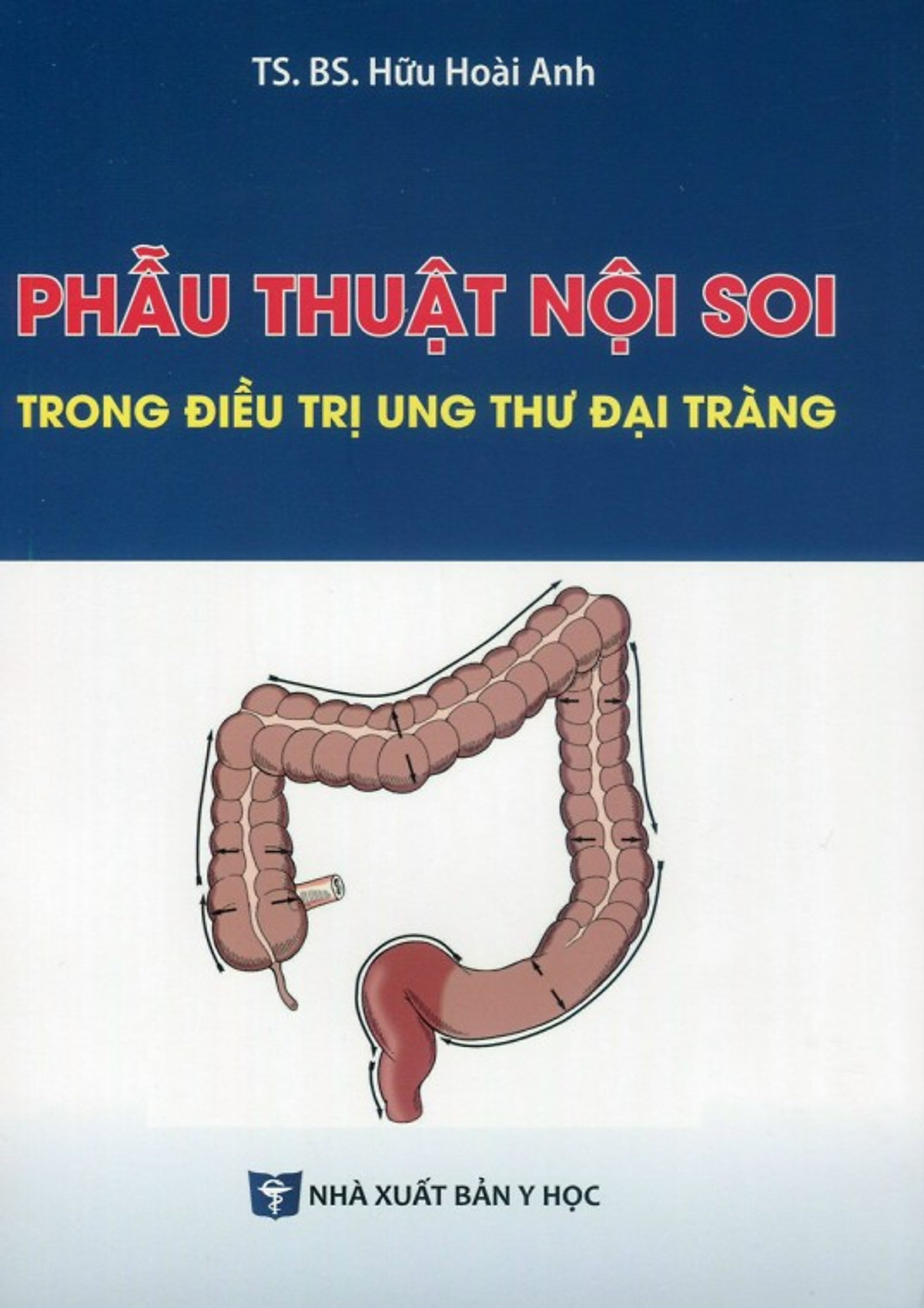 Phẫu Thuật Nội Soi Trong Điều Trị Ung Thư Đại Tràng