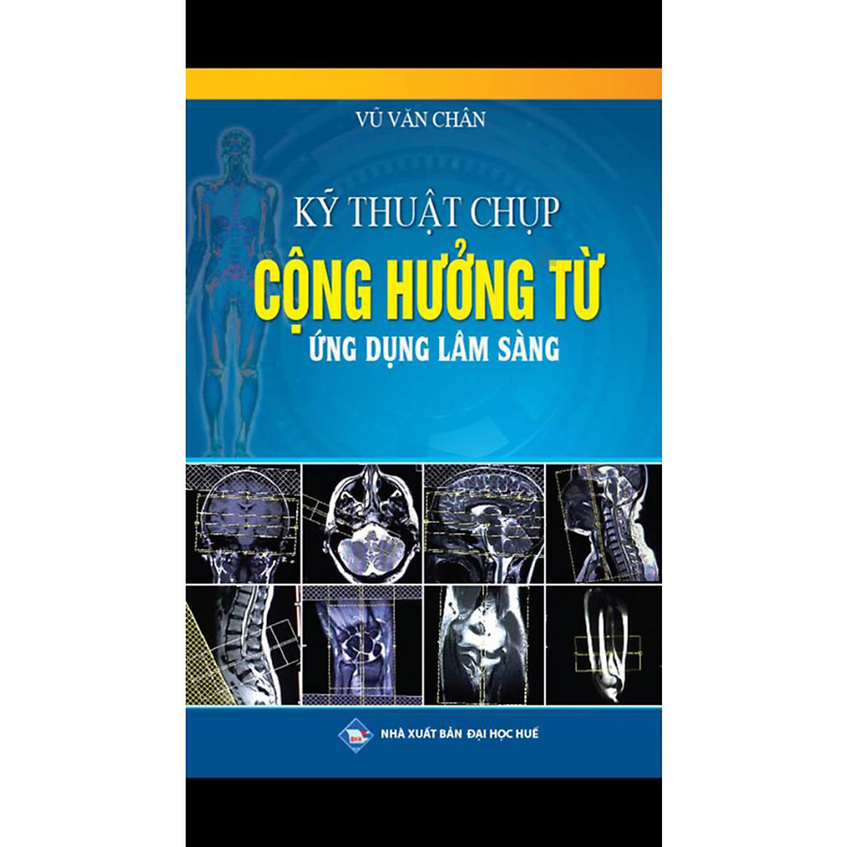 Kỹ thuật chụp Cộng Hưởng Từ Ứng dụng trong lâm sàng