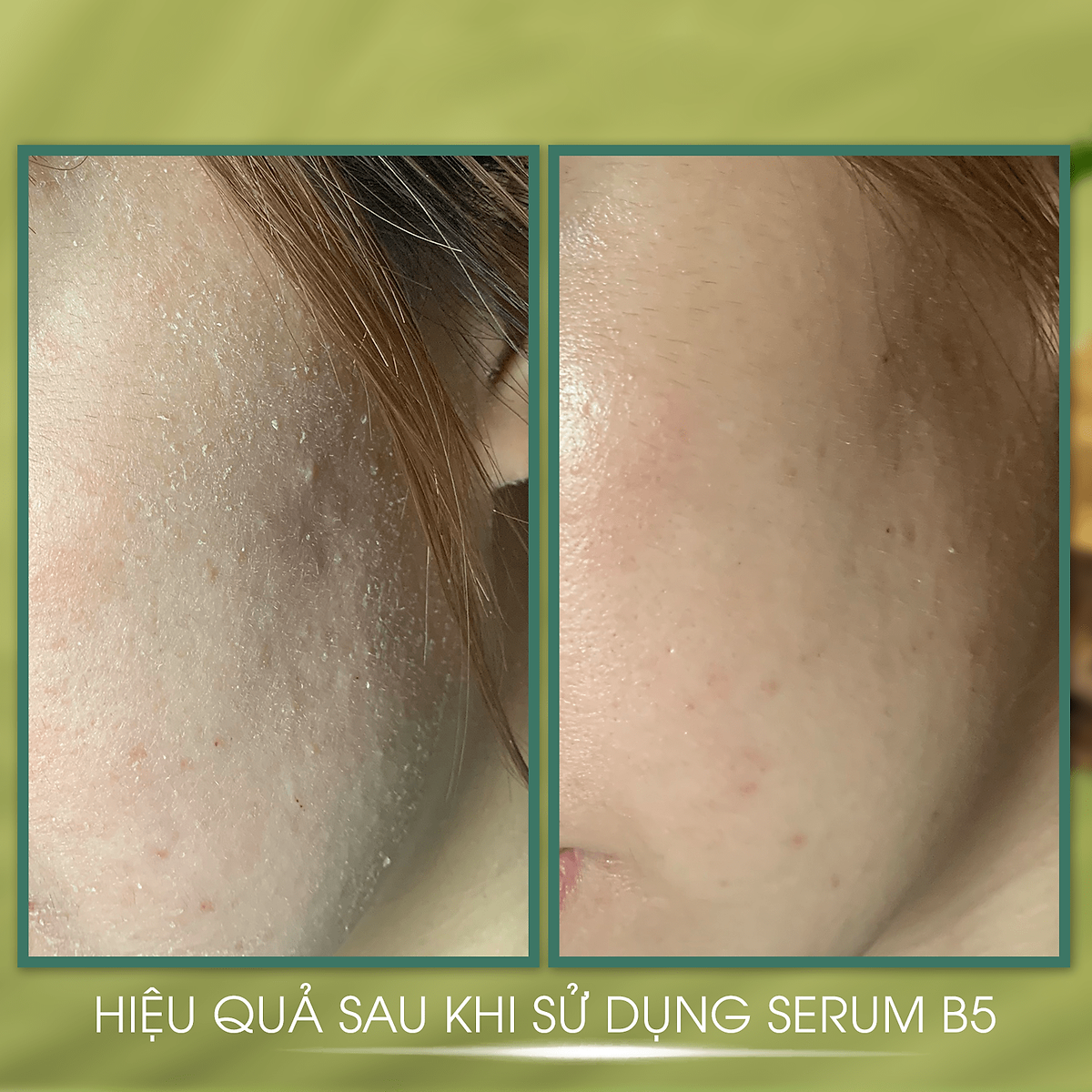 COMBO SẮC HỒNG RẠNG RỠ] Giúp Phục Hồi, Dưỡng Trắng Da Và Chống Lão ...