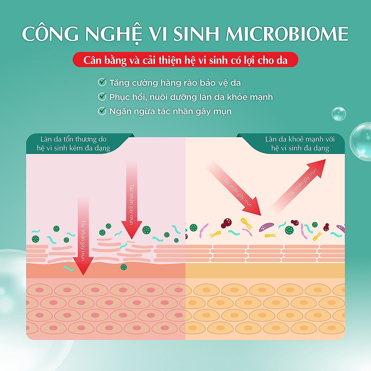 Kem dưỡng ẩm cho da mụn, nhạy cảm Hada Labo dạng gel Acne Care Calming Gel Cream 50g