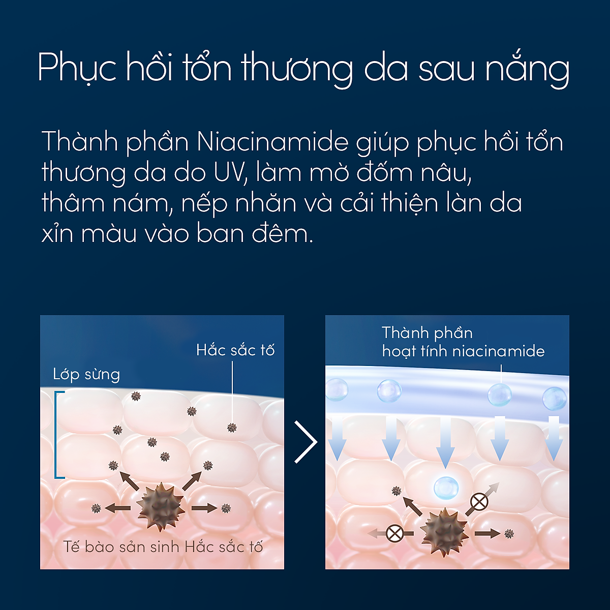 Bộ sữa chống nắng dưỡng da kiềm dầu bảo vệ hoàn hảo SPF50+ PA++++ 60ml và Serum dưỡng da và phục hồi da sau nắng 180ml Anessa